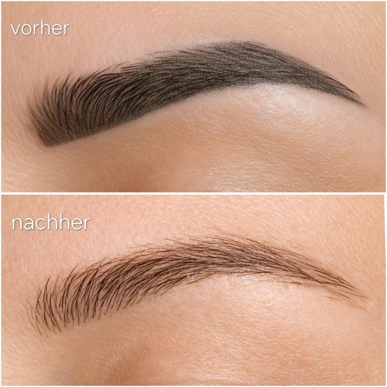 Tattoo Entfernung PMU Entfernung